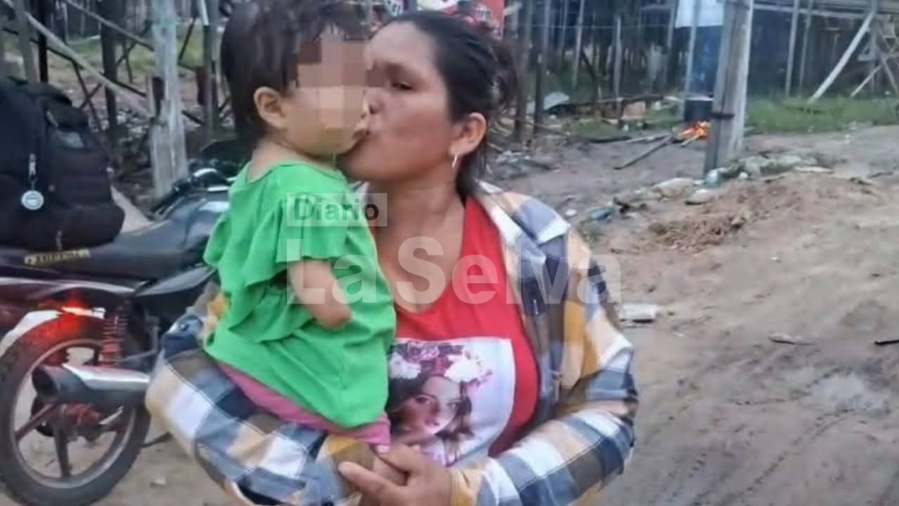 Madre de niña que nació sin manos solicita ayuda urgente