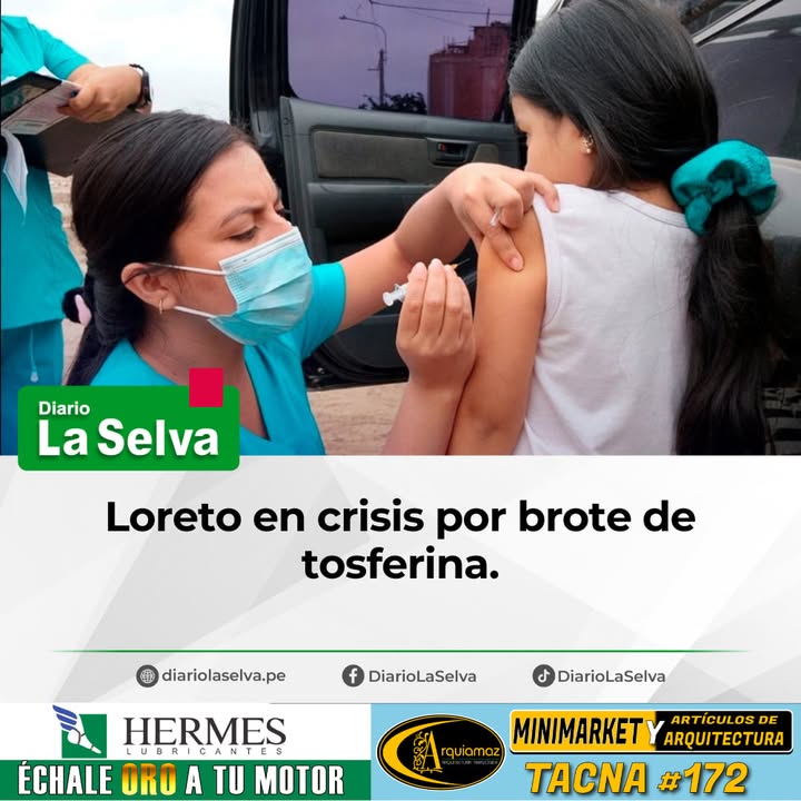 Aumentan los casos de tos ferina en el Perú: 46 muertes en lo que va del 2025