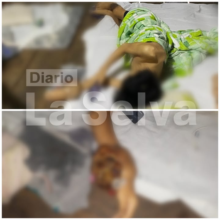 Joven sufre con tumor en la mano y necesita ayuda urgente