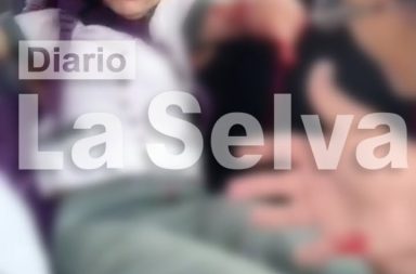 ESTUDIANTE SUFRE GRAVE ACCIDENTE EN LA AV. QUIÑONES