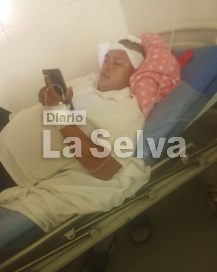 OBRERO SUFRE GRAVE ACCIDENTE LABORAL Y RESULTA HERIDO