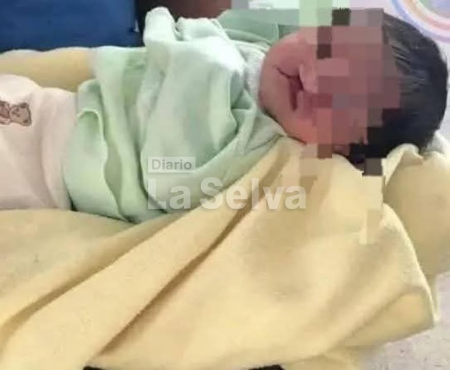 Bebé recién nacida es abandonada en la vía pública por nacer con labio leporino