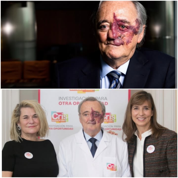 Investigador logra eliminar por completo el cáncer de páncreas en ratones