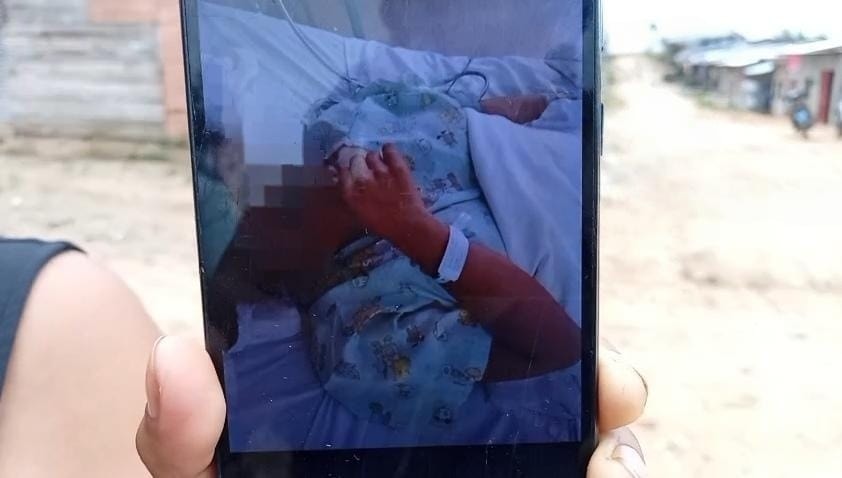 Adolescente loretana pierde un riñón tras atropello y lucha por su vida en Moquegua