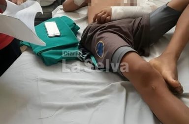 Adolescente herido por disparo accidental durante caza en Loreto
