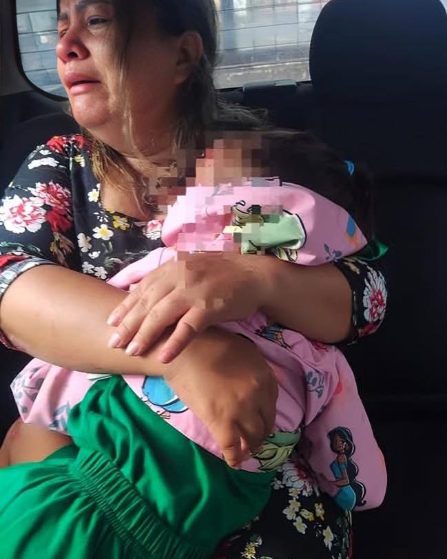 Accidente por esquivar a un perro deja dos heridas en la carretera a Santa Clara.