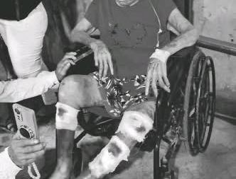 *MUJER NONAGENARIA RESULTA HERIDA EN ACCIDENTE VIAL TRAS REGRESAR DEL SEPELIO DE SU HIJA*