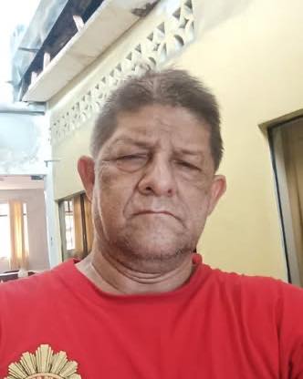 Bombero resulta herido tras colapso de buzón en transitada calle de Iquitos.
