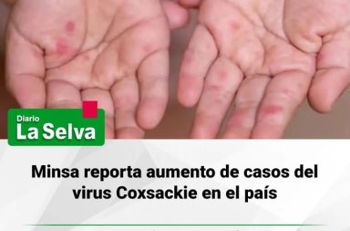 Incrementan contagios del virus Coxsackie y suspenden clases en algunos colegios