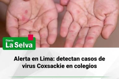#Lima  Reportan contagios de virus Coxsackie en colegios de Lima