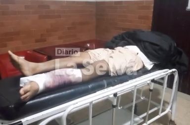 Accidente doméstico deja herido