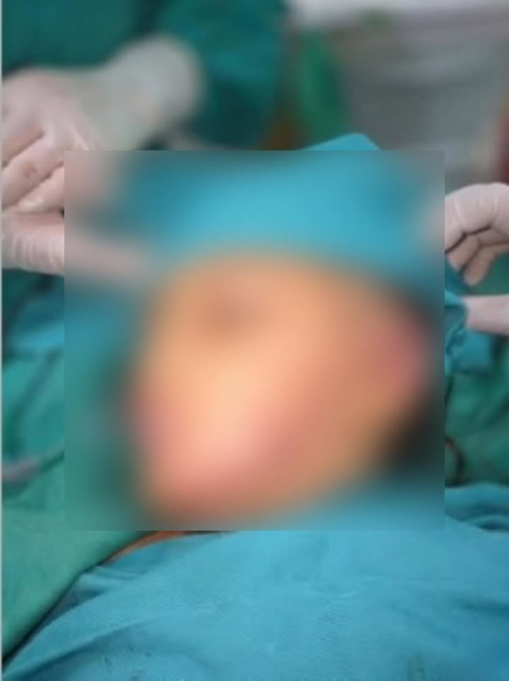 Médicos del Hospital Regional reconstruyen rostro de niña atacada por perro en Iquitos.