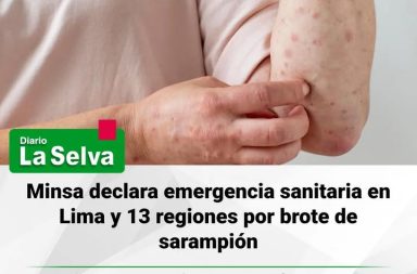 Gobierno declara emergencia sanitaria por incremento de casos de sarampión