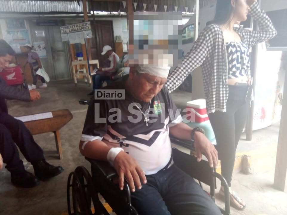 Hombre fue atacado cuando salía de su vivienda rumbo a carretera Iquitos–Nauta