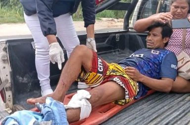 Un accidente laboral ocurrido en el centro poblado Varillal movilizó a agentes de Serenazgo de San Juan Bautista, luego de que el ciudadano Pepe Armas Sangama sufriera una grave lesión mientras manipulaba una herramienta de corte en su vivienda.