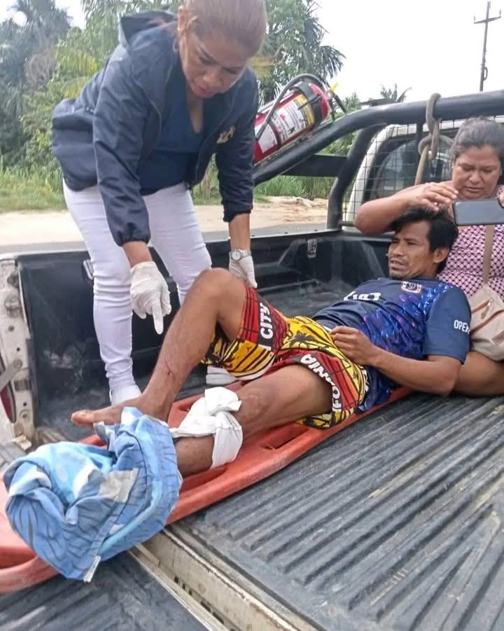 Un accidente laboral ocurrido en el centro poblado Varillal movilizó a agentes de Serenazgo de San Juan Bautista, luego de que el ciudadano Pepe Armas Sangama sufriera una grave lesión mientras manipulaba una herramienta de corte en su vivienda.