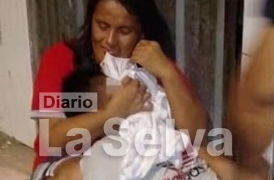 Joven padre de familia resulta herido en accidente de tránsito en el centro de Iquitos.