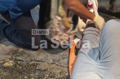 Motociclista pierde el control y termina chocando contra un muro en Iquitos.
