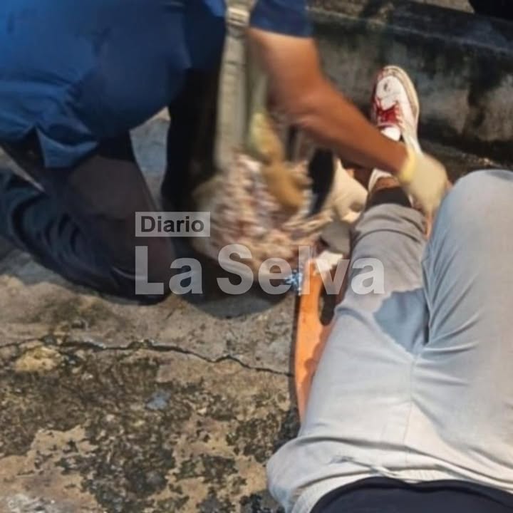 Motociclista pierde el control y termina chocando contra un muro en Iquitos.