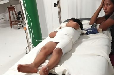 Menor permanece internado tras accidente con sopa hirviendo