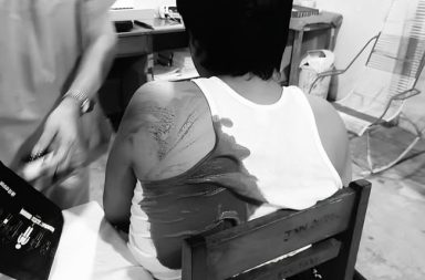 JOVEN ES ACUCHILLADO POR LA ESPALDA POR UN COMPAÑERO DEL IESTP PEDRO A. DEL ÁGUILA DE IQUITOS